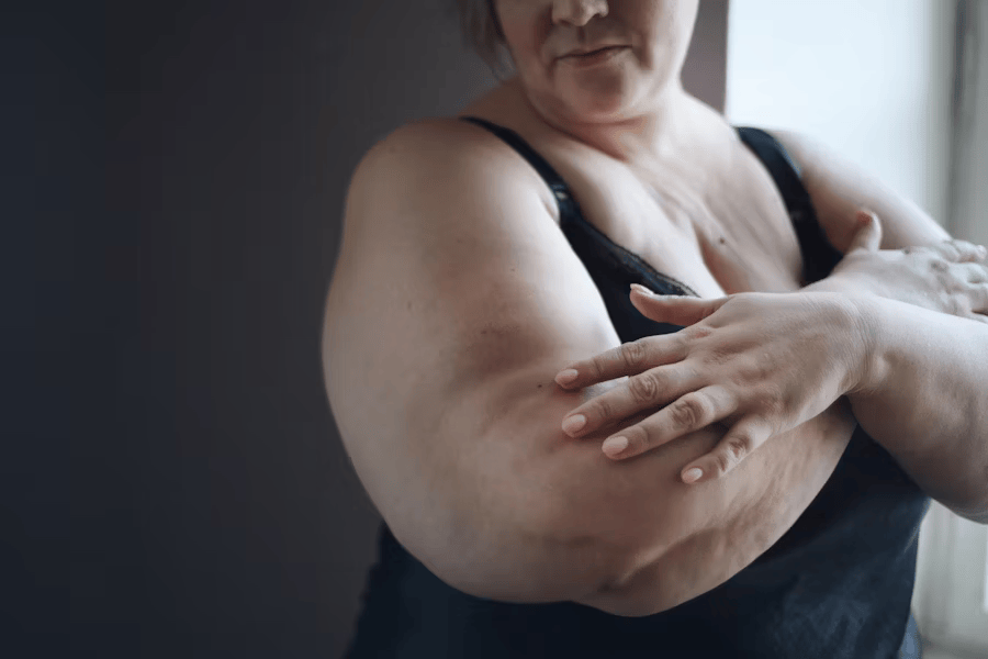 Erfahre, wie der BMI Übergewicht klassifiziert, wann es gesundheitlich bedenklich wird und welche Schritte Du für mehr Wohlbefinden unternehmen kannst.